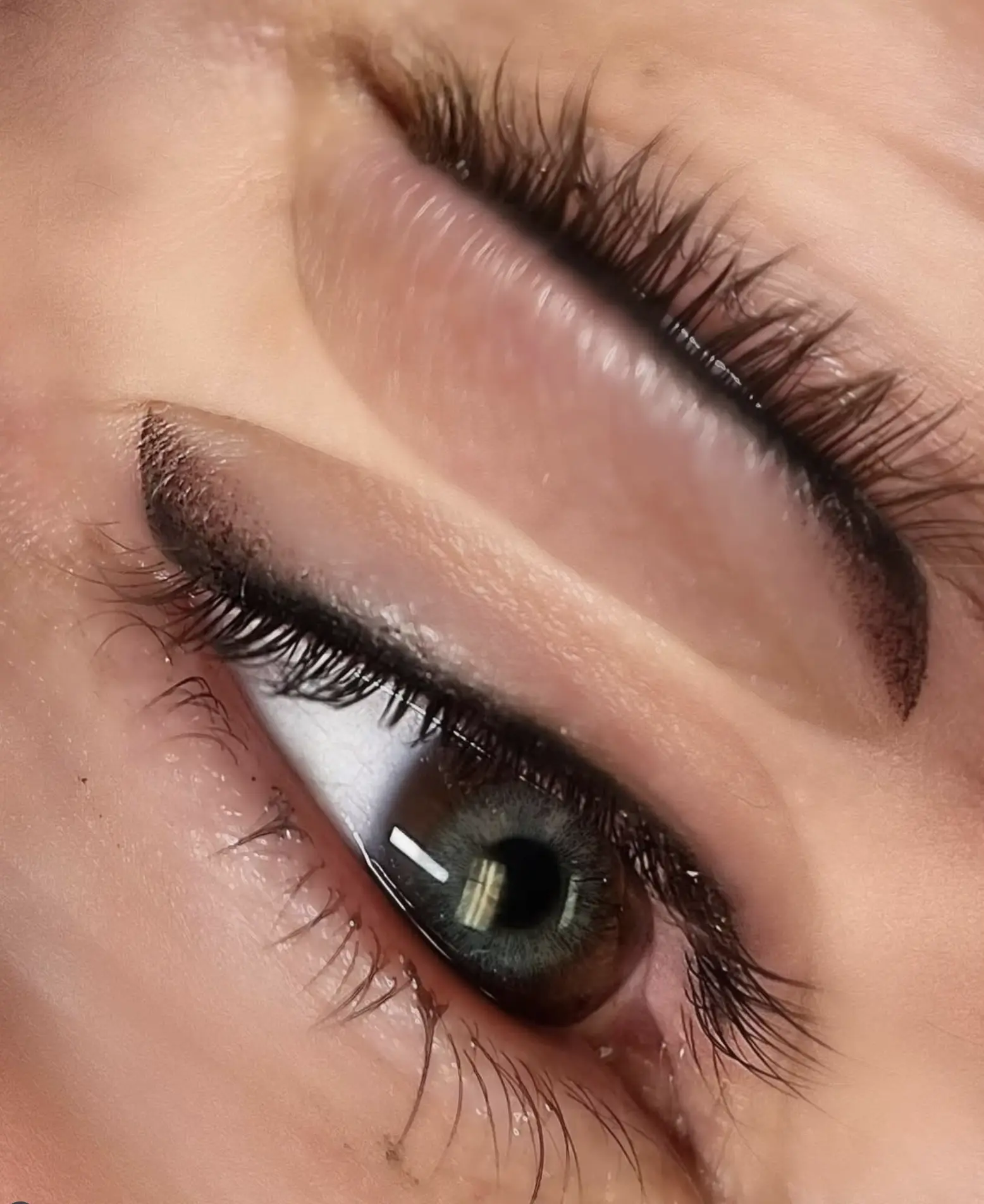 Healed lash line