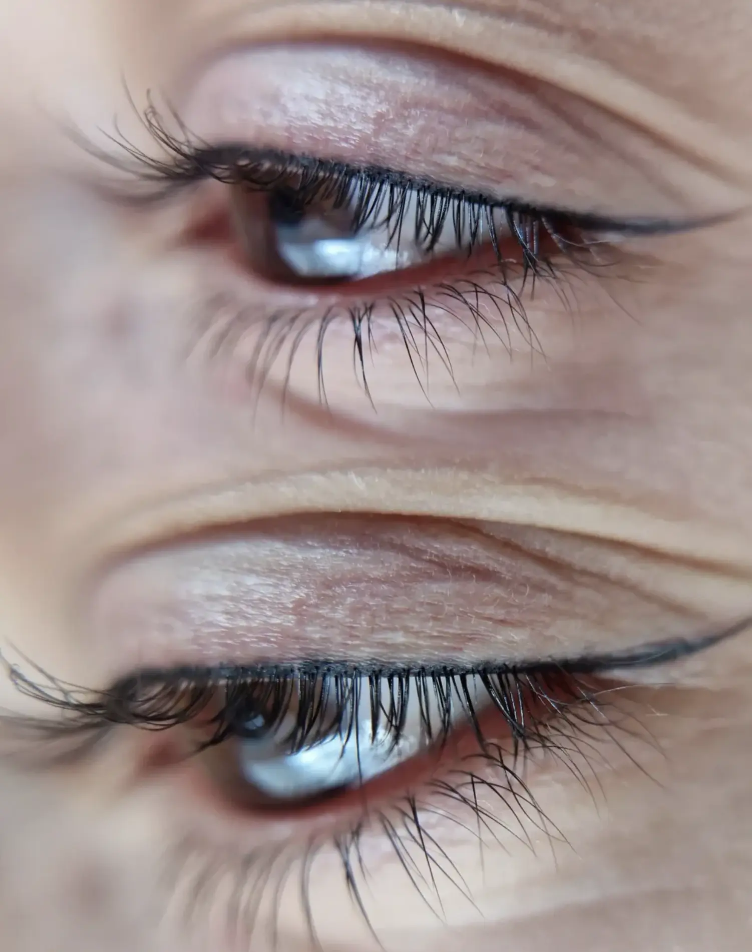 Permanent eyeliner healing