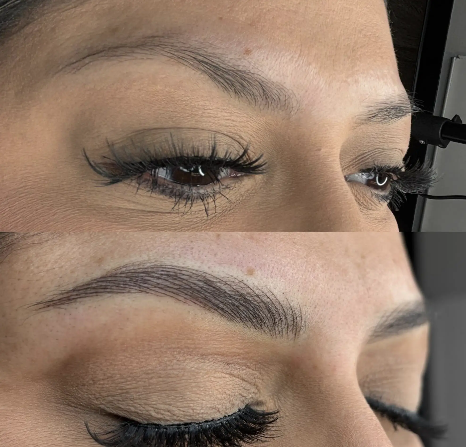 saline eyebrow tattoo removal